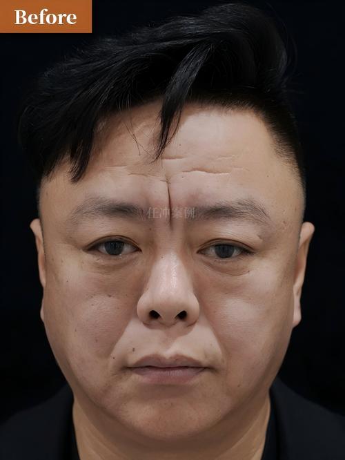 老刘皱眉咨询